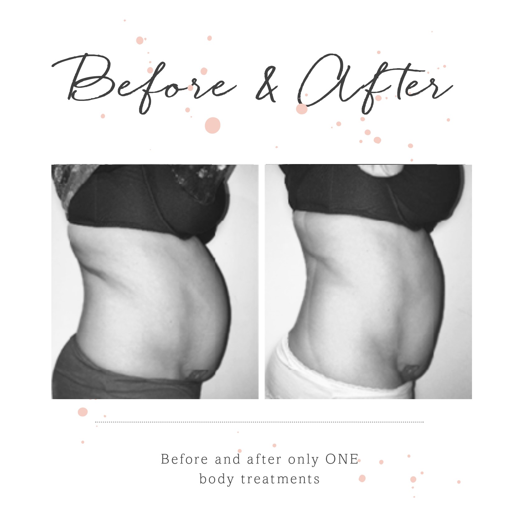 Before&After_body2